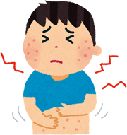 湿疹、蕁麻疹